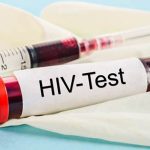 Test nhanh HIV sau bao lâu thì chính xác?