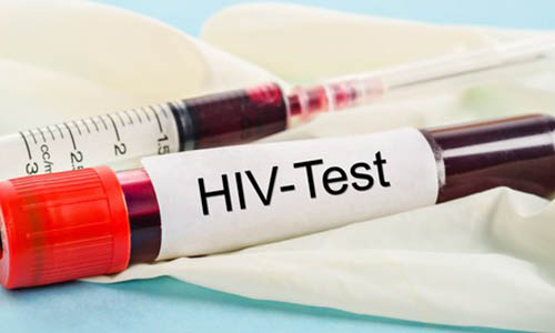 test nhanh HIV sau bao lâu thì chính xác