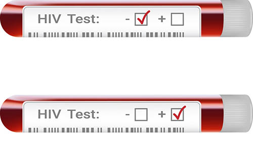 Test nhanh HIV 