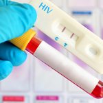 Xét nghiệm HIV hết bao nhiêu tiền?