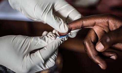 HIV ở Đông và Nam Phi
