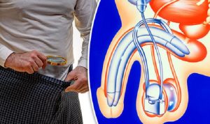 Sóng xung kích rối loạn cương dương là gì? Quá trình điều trị? Hiệu quả đem lại?