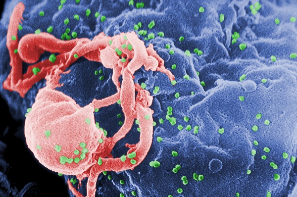 Virus HIV tấn công vào hệ miễn dịch của cơ thể làm hệ miễn dịch suy giảm, cuối cùng là bị vô hiệu hoá