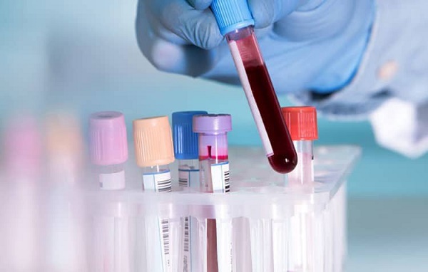 Xét nghiệm máu cơ bản chỉ cho biết các thành phần trong máu, chỉ số đường huyết, mỡ máu và chức năng gan