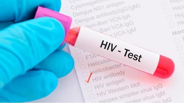 Nên xét nghiệm kháng thể HIV cho tất cả các bệnh nhân nhiễm HBV trước khi bắt đầu điều trị bằng thuốc Vemlidy 