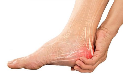 Đau có thể xuất hiện ở gót chân phía trước hoặc gót chân phía sau, và có thể lan ra cả khắp vùng gót chân